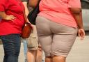 Obesity is to become biggest cause of cancer in the next 20 years