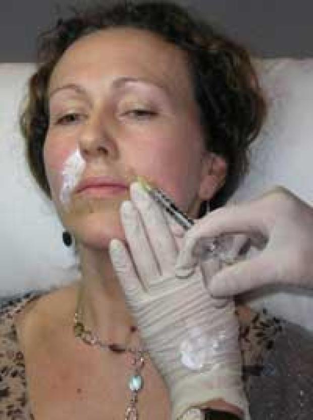 Chemical denervation proceedure