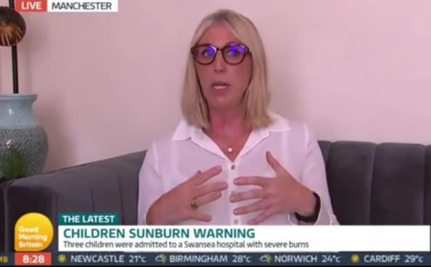 News Shopper: Dr Sarah Carlick said sunburn is a matter of safe guarding