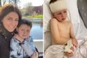 A four-year-old boy was diagnosed with a brain tumour after going three years being misdiagnosed with sinus problems and blocked tear ducts.