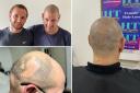 The 62-year-old decided to tattoo his hair after losing confidence.