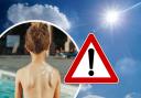 Expert: Parents who let their kids get severely sunburnt should be FINED