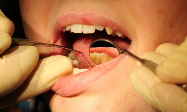 Figures reveal the coronavirus pandemic's huge impact on dental care in Bexley, Bromley, Greenwich and Lewisham