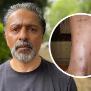 South London dad Danny Afzal said the communal areas of his block of flats in Lewisham Park had been left flea-infested for almost a year, despite persistent complaints